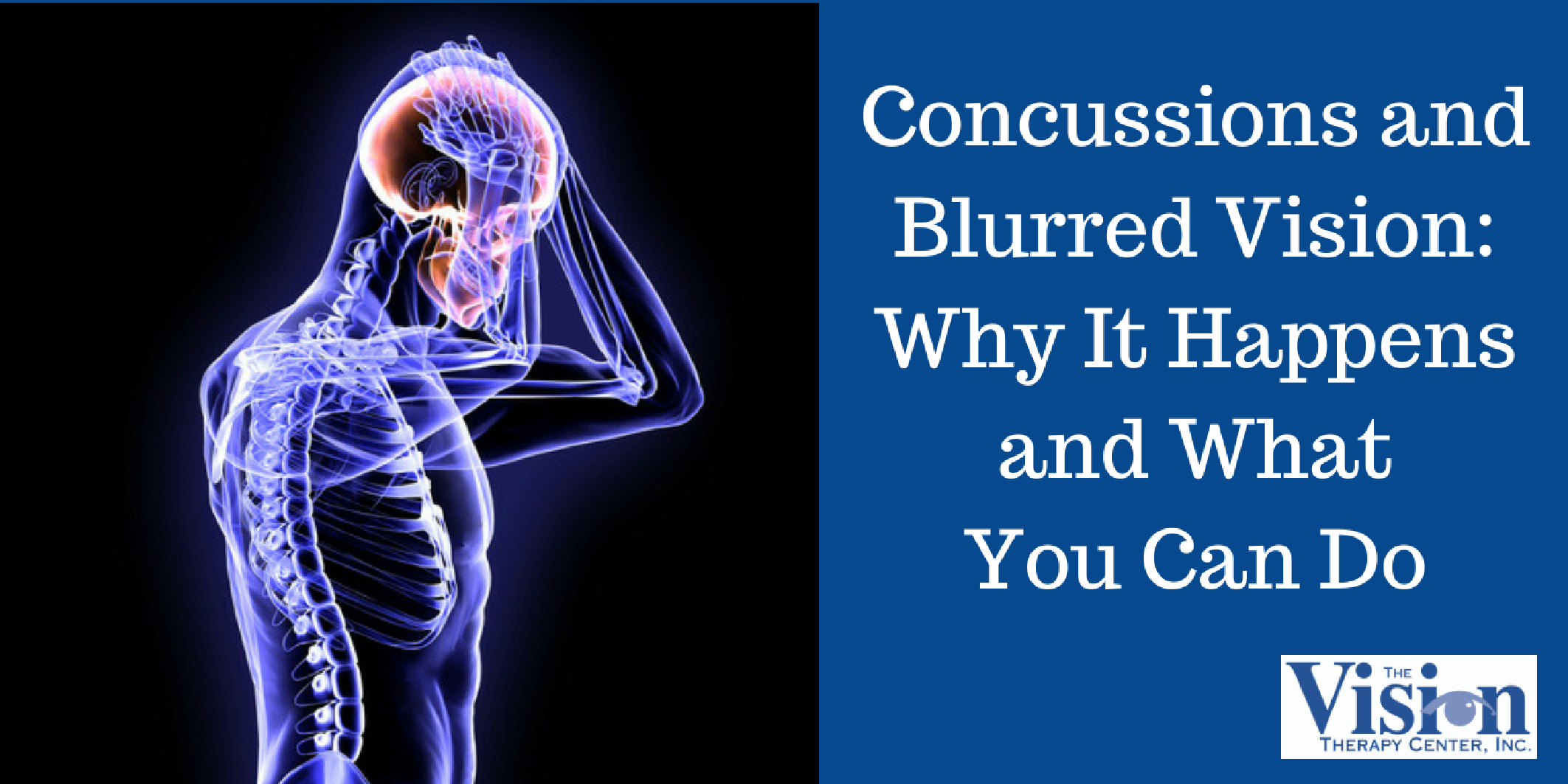 Concussions and Blurred Vision Why It Happens and What You Can Do